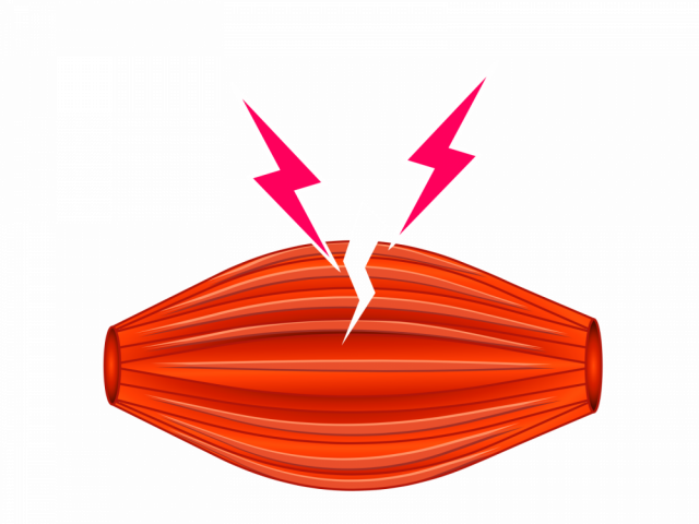 肉離れ 藤沢の整体 医師も推薦 湘南モールあおば鍼灸整骨院